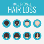 Hauterkrankung - Erblicher Haarausfall Beispiele